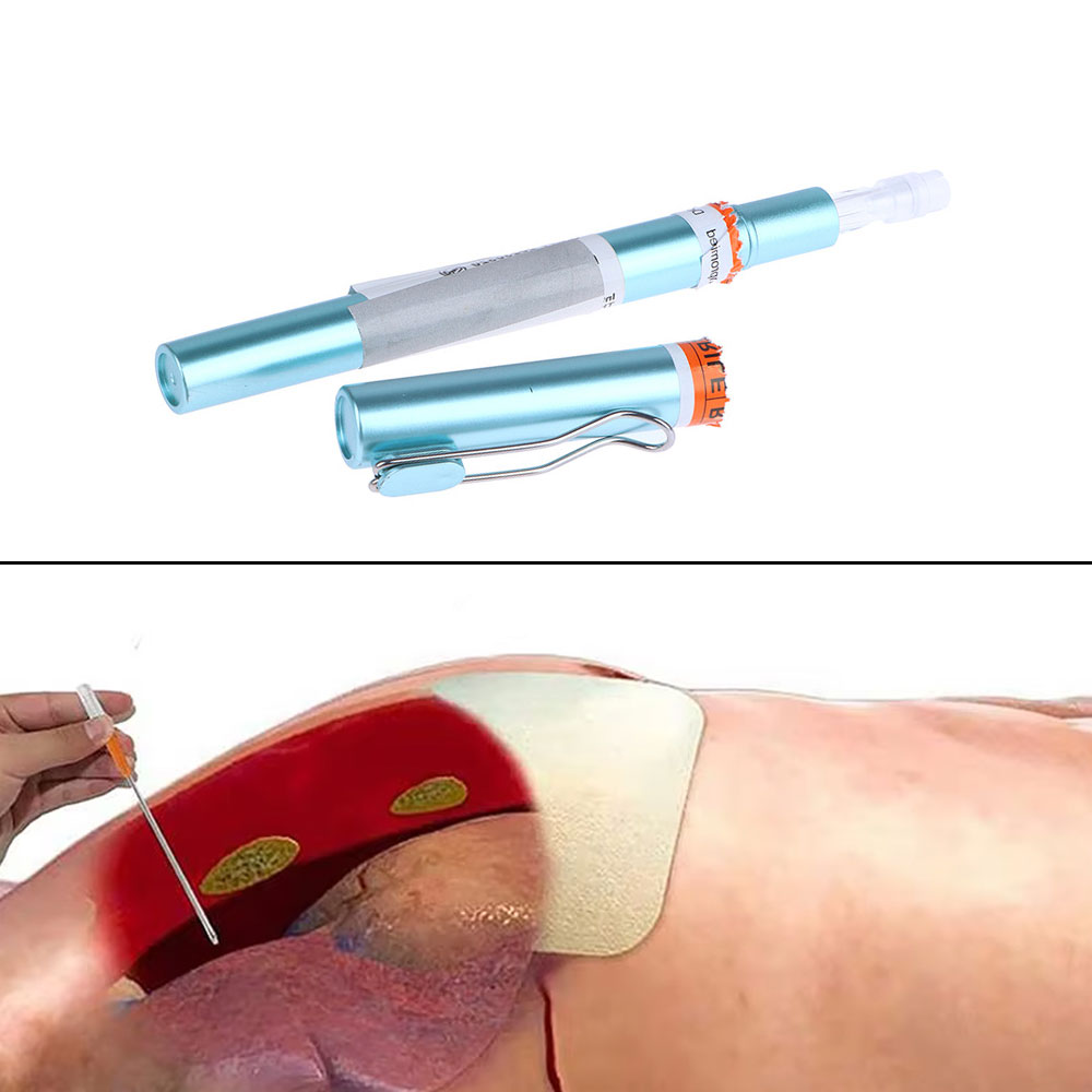 1セット：緊急用具、応急処置キット、気胸用穿刺針、胸部減圧用 - First Aid Kit のレビューと価格